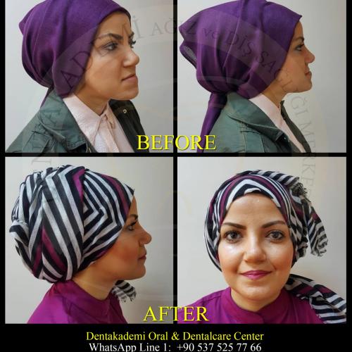 Before after photos of our patients 2